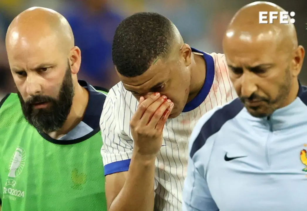 El franc&eacute;s Kylian Mbapp&eacute; sufre fractura de nariz, como consecuencia del golpe sufrido en un choque fortuito con Danso en el partido que enfrent&oacute; a Austria contra Francia (0-1) en el debut de ambas selecciones en el grupo D de la Eurocopa. EFE/EPA/FRIEDEMANN VOGEL